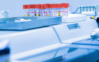 DUTCH Test for Perimenopause: What It Is and Why It Matters