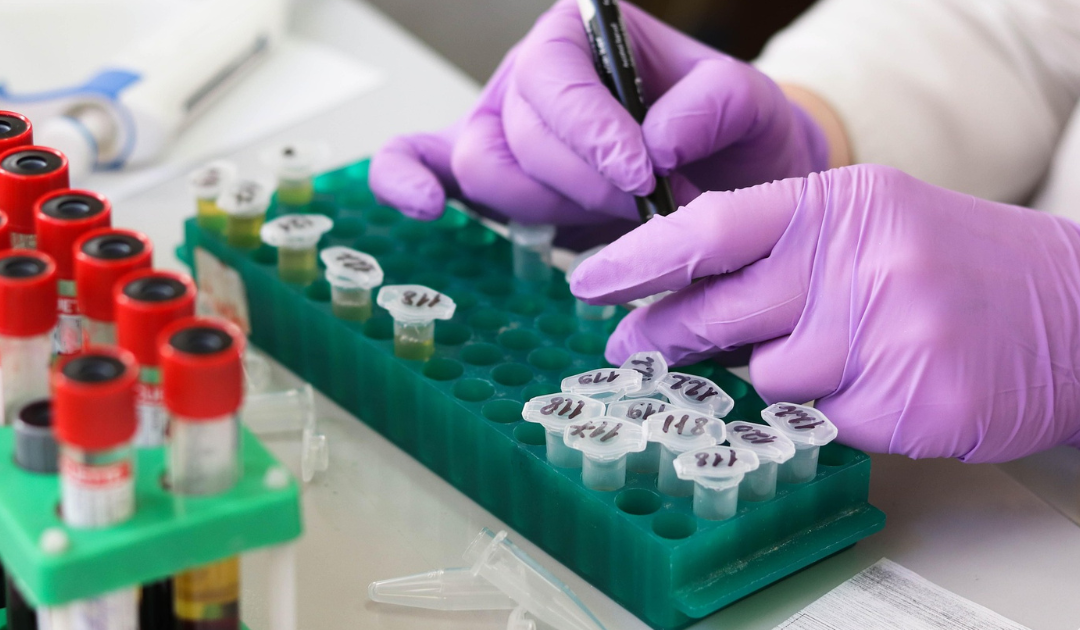 DUTCH Test vs Blood Test: Which Hormone Test Is Right for You?