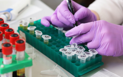 DUTCH Test vs Blood Test: Which Hormone Test Is Right for You?