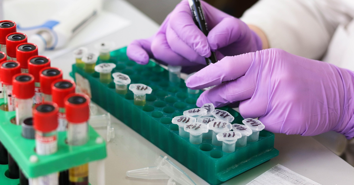 DUTCH Test vs Blood Test: Which Hormone Test Is Right for You?