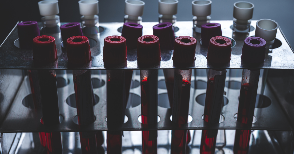 Types of Hormone Testing